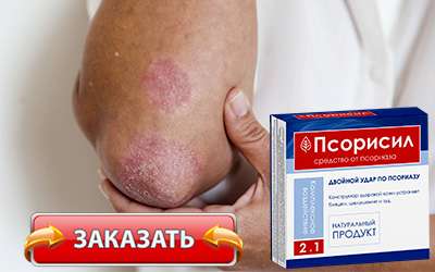 Псорисил купить в аптеке