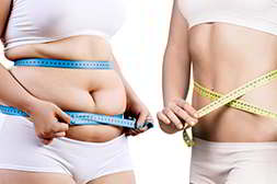 Женщина до и после применения keto slim