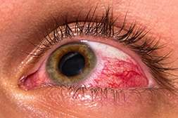 Благодаря Crystal Eyes предотвращается развитие серьёзных патологий зрения.