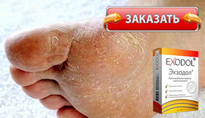 Экзодол купить в аптеке.
