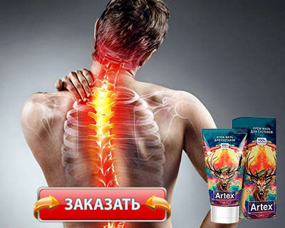 Мазь Artex купить по доступной цене.