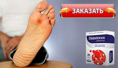 Препарат Диабетонус купить по доступной цене.