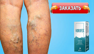 Vorifex купить в аптеке.